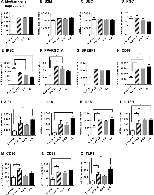 Altered gene expression in NAFLD rat model: genes associated with NAFLD pathology.