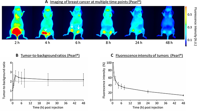 Near-infrared fluorescence imaging of breast cancer (MCF-7).