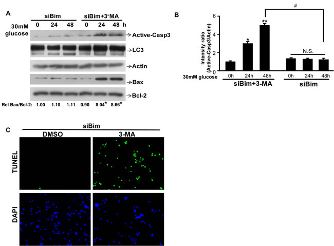 Autophagy inhibitor 3-MA worsens theinjury of high glucose in Bim reduced cells by re-trigger apoptosis.