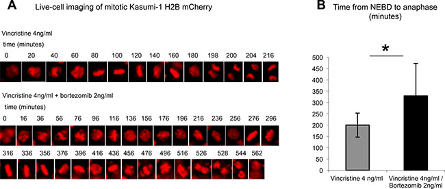 Concomitant application of bortezomib prolongs a vincristine-induced mitotic delay in Kasumi-1 cells.