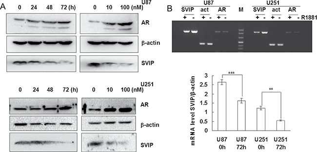 AR inhibits SVIP expression on transcriptional level in glioma cell lines.