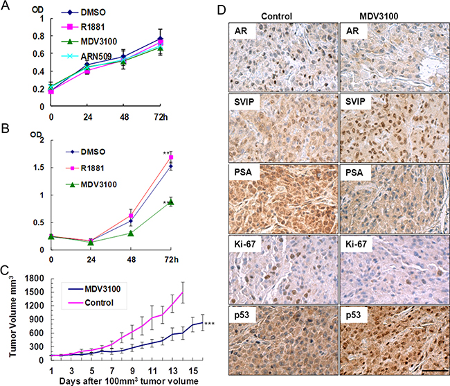 AR antagonist inhibited U87 proliferation in vitro and in vivo, but it had no effect on U251.