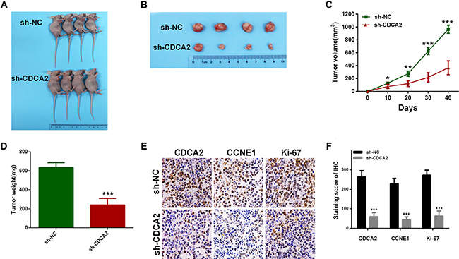 Knockdown of CDCA2 inhibits tumor growth in vivo.