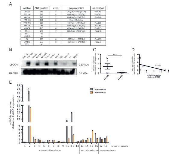 Expression of miR-34a and L1CAM are inversely correlated in EC cell lines and cancer tissues.