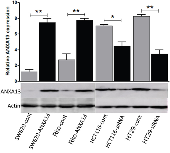 Annexin A13 level is upregulated by ANXA13 overexpression and downregulated by ANXA13-siRNA.