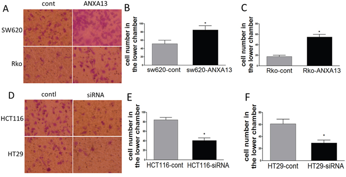 ANXA13 regulates CRC cell invasion in vitro invasion assays.