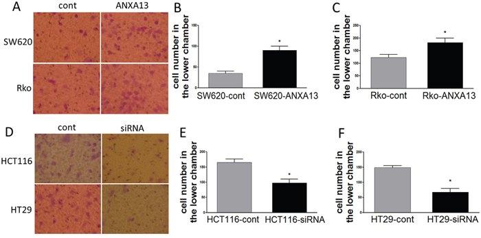 ANXA13 regulates CRC cell migration in vitro migration assays.