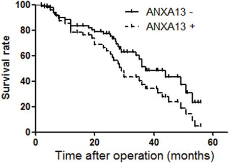 ANXA13 expression and survival of patients with CRC.