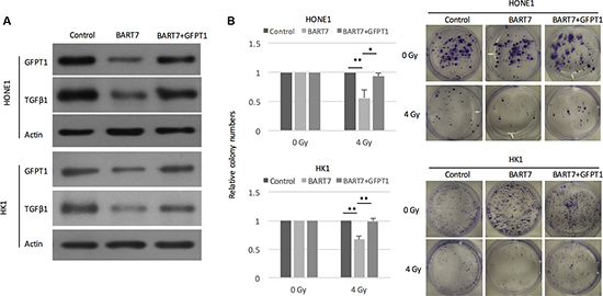 Ebv-miR-BART7 enhanced radiosensitivity by targeting GFPT1-TGF&#x03B2;1 pathway.