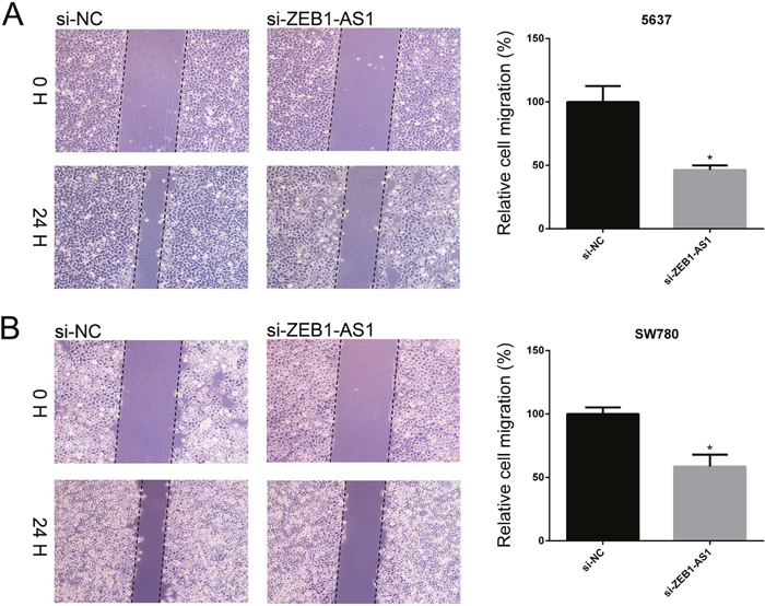 Down-regulation of ZEB1-AS1 inhibited migration of bladder cancer cells by wound-healing assay.