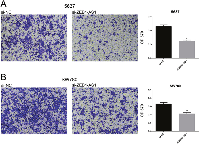Down-regulation of ZEB1-AS1 inhibited migration of bladder cancer cells by transwell assay.