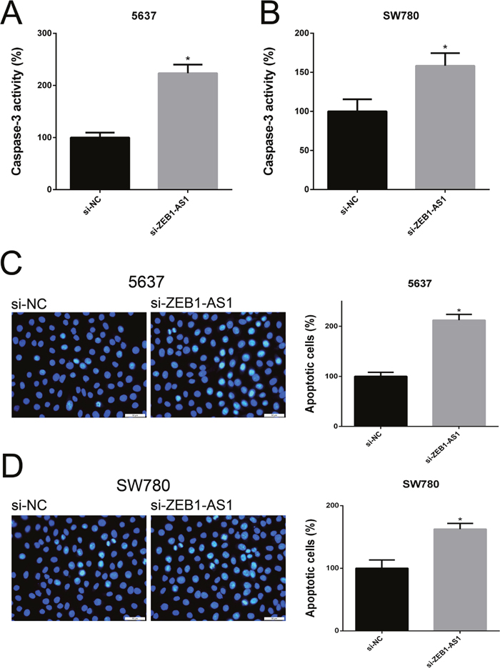 Down-regulation of ZEB1-AS1 induces apoptosis of bladder cancer cells by ELISA and Hoechst 33258 staining assay.