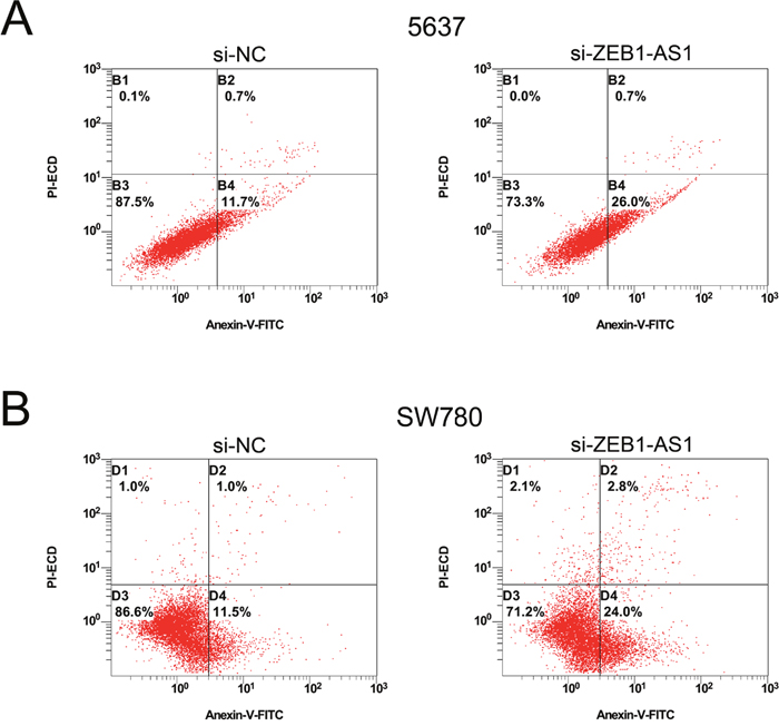Down-regulation of ZEB1-AS1 induces apoptosis of bladder cancer cells by flow cytometry assay.