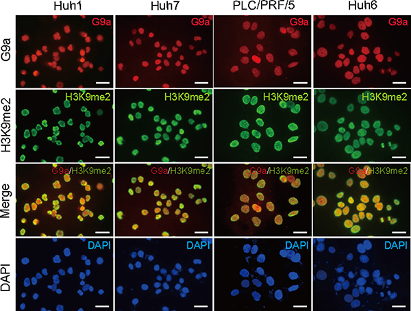 Basal expression levels of G9a and H3K9me2 in Huh1, Huh7, PLC/PRF/5, and Huh6 cells.