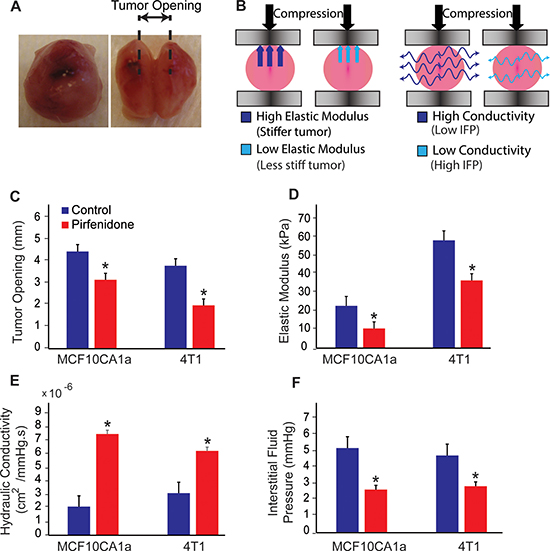 Pirfenidone normalizes solid and fluid stress in tumors.