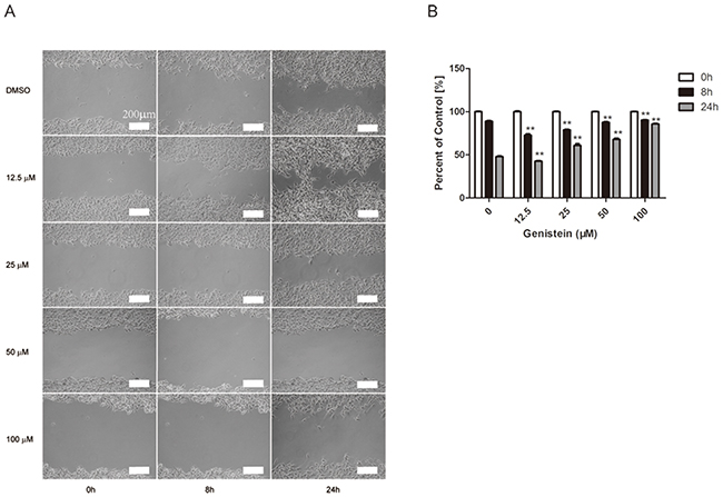Genistein inhibits the mobility of B16F10 cells.