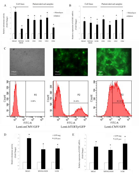 Osteosarcoma cells are heterogeneous according to their telomerase activity.