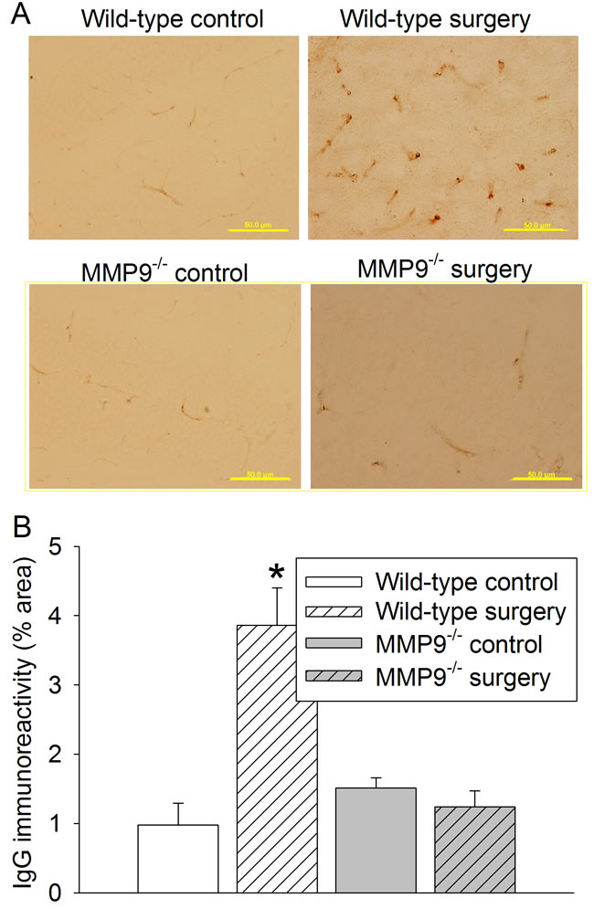 Effects of surgery on permeability of IgG into brain tissues in wild-type and MMP9