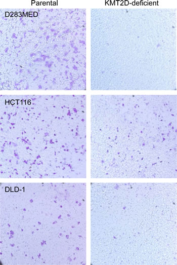 KMT2D deficiency attenuates cell migration.