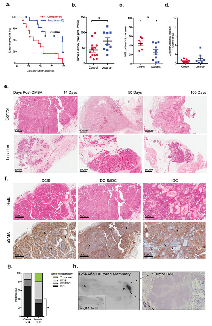 Inhibition of AT1R with Losartan decreases mammary tumor onset and progression associated with MPA and DMBA treatment.