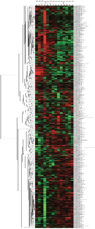 Kinase gene expression (NanoString) of normal and tumor samples.