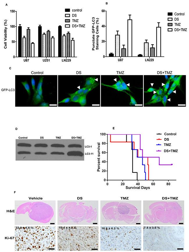 Combination activity of DS7423 and TMZ in GBM cells in vitro and in vivo.