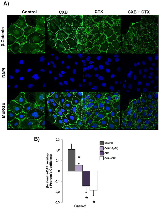 Combined Celecoxib/Cetuximab treatment alters subcellular distribution of &#x03B2;-catenin in Caco-2 cells.