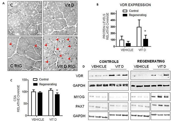 Effects of VitD administration during muscle regeneration.
