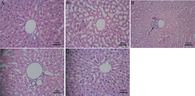 Pathomorphology in rat liver.