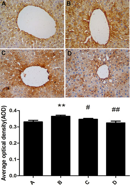 Effect of meloxicam on changes of liver COX2 protein expression in chronic Al-overload rats.