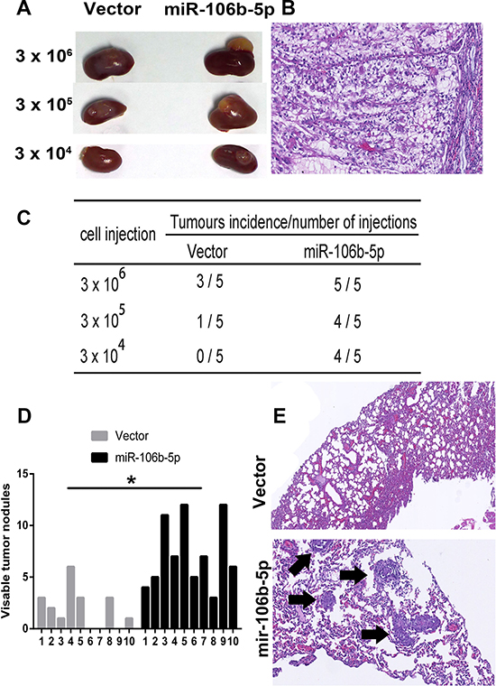 miR-106b-5p enhances the tumorigenicity and metastasis of ccRCC cells in vivo.