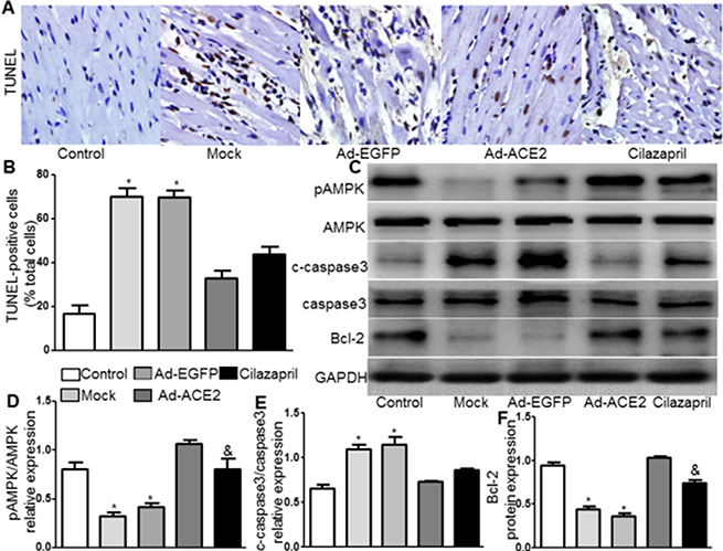 TUNEL staining and AMPK, caspase3, and Bcl-2 protein expression in five groups of rats 4 weeks after gene transfer.