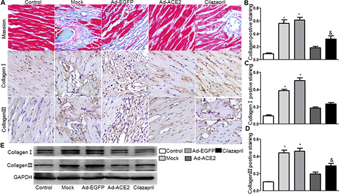 Masson&#x2019;s trichrome staining of myocardium and collagen protein expression in five groups of rats 4 weeks after gene transfer.