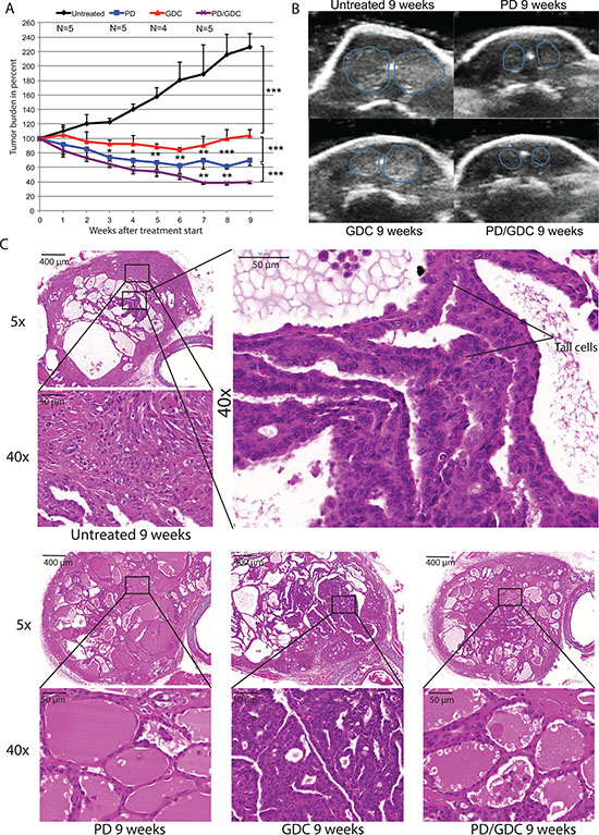 The combination is more beneficial after 9 weeks of treatment in terms of tumor burden reduction compared to PD alone and shows histology improvement.