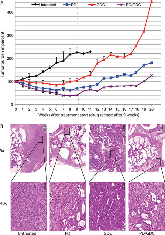 Tumors regrow after treatment release with different rate and seem to lose the histological improvement observed under treatment.