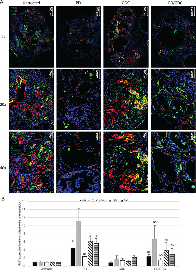 MEK inhibition alone or combined with Pi3&#x2032;-kinase inhibition leads to a reduction in tumoral markers and an up-regulation of normal phenotype markers.