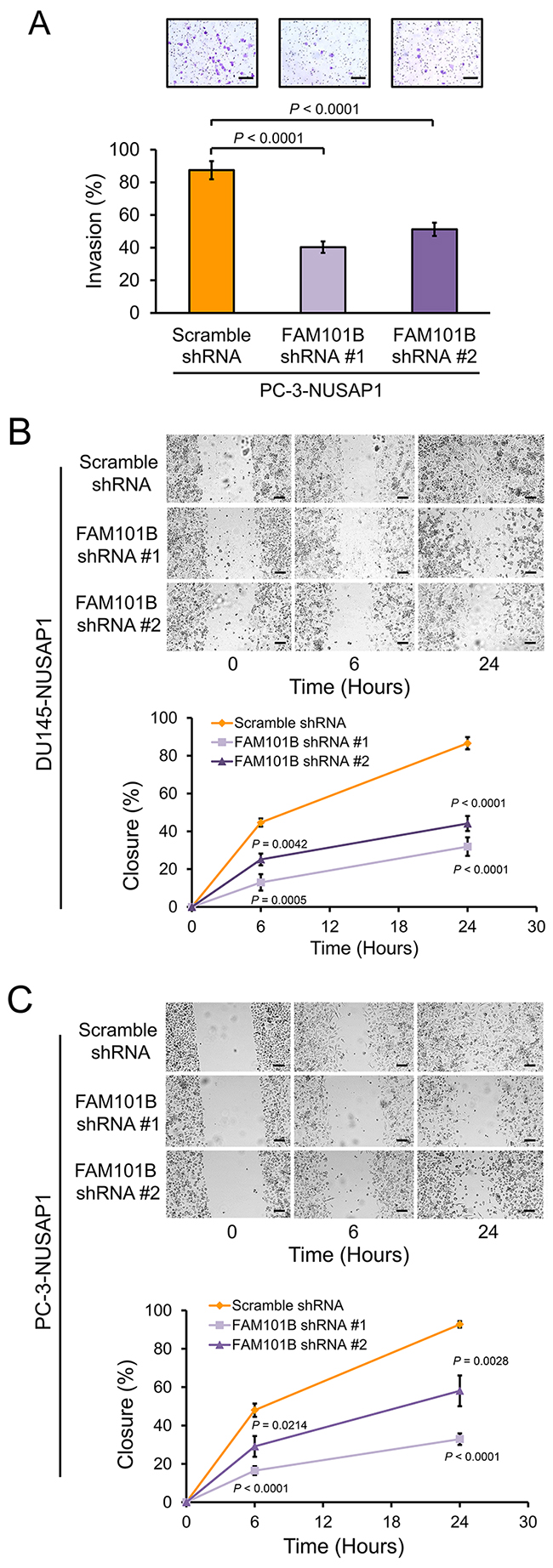Knockdown of FAM101B decreases invasion and migration of prostate cancer cells.