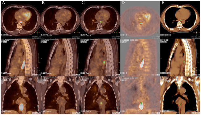 PET/CT images of a representative patient.