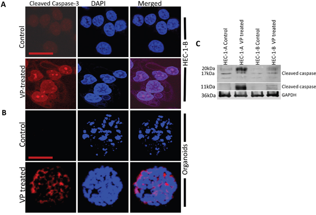 VP induces caspase-3 mediated apoptosis in HEC-1-B Cells and organoids.