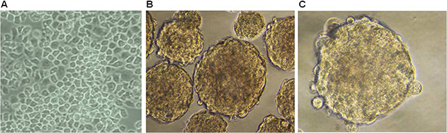 Spheroid formation is evident in ESCC KYSE 450 cells.