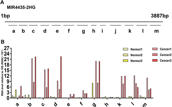 Expression of diverse MIR4435-2HG fragments in health control and gastric cancer plasma.