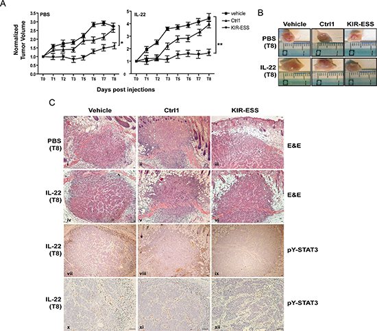 KIR-ESS efficiently targets STAT3 phosphorylation in SCC xenografts and inhibits tumor growth in nude mice.