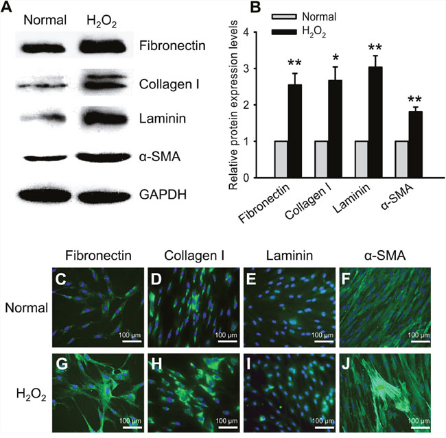 Oxidative stress promoted ECM protein expression.