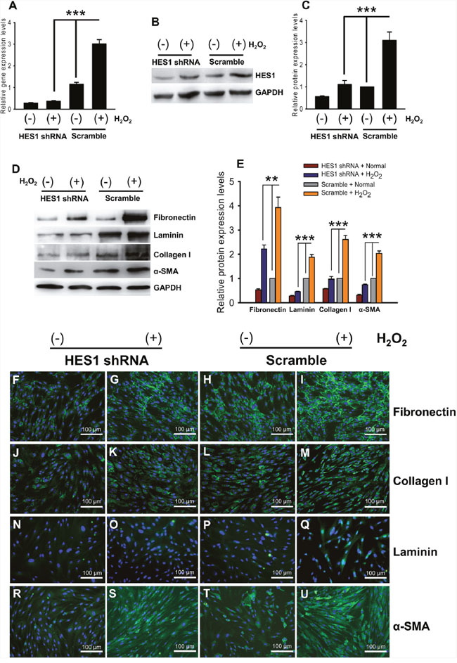 HES1 knockdown abrogated the up-regulation of ECM proteins in the HTMCs under oxidative stress.