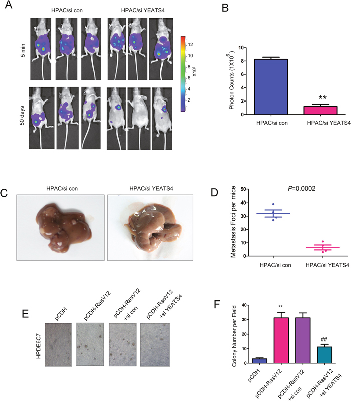 Down-regulating YEATS4 inhibited the metastasis of pancreatic cancer cells.