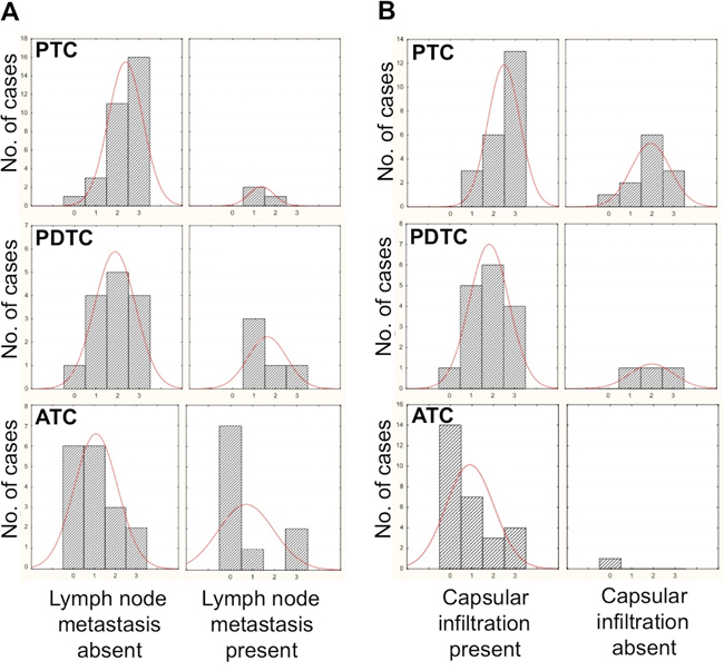 Correlation between staining intensity with the anti-&#x03B1;-L-FUCA-1 antibody and presence or absence of lymph-nodal metastases in all PTC, PDTC and ATC samples analyzed A.