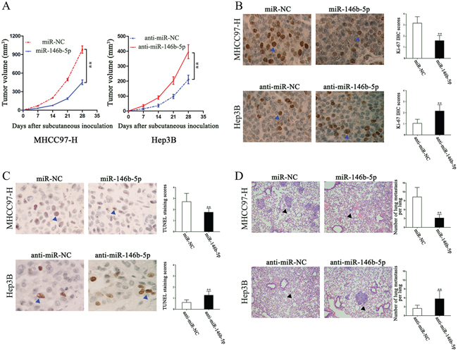 The in vivo effects of miR-146b-5p on tumor growth and metastasis of HCC.
