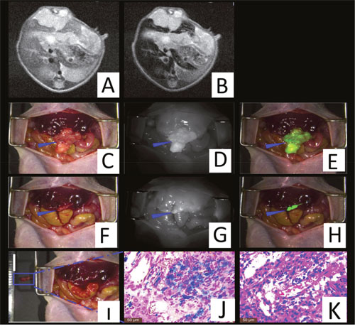 Theranostic imaging in the orthotopic liver tumors models.