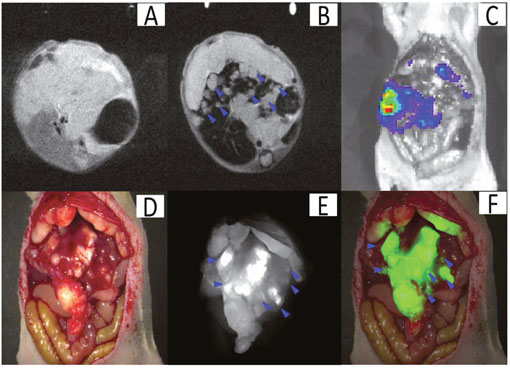 Theranostic imaging in the orthotopic liver tumors with intrahepatic metastasis.
