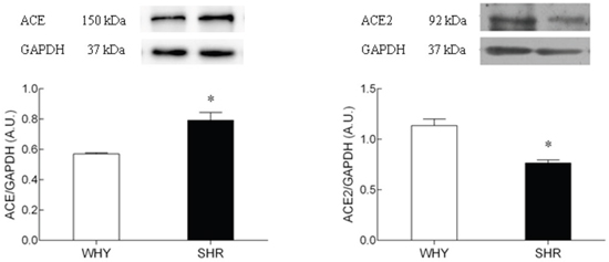 The protein expression of ACE2 on hypothalamus of SHR compared with WKY.